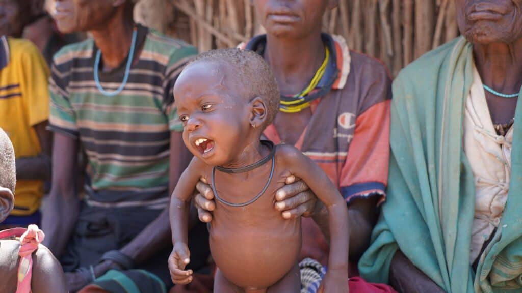 Unterernährtes Kind im Gewahrsam von Erwachsenen in einem afrikanischen Dorf
