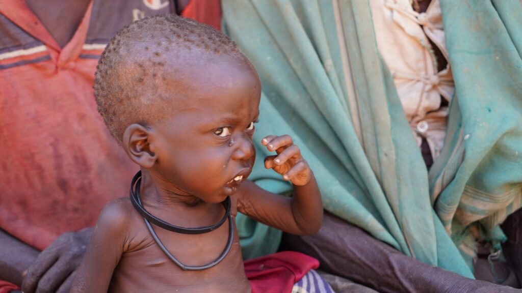 Unterernährtes Kleinkind in Afrika, das Anzeichen von starkem Hunger zeigt.