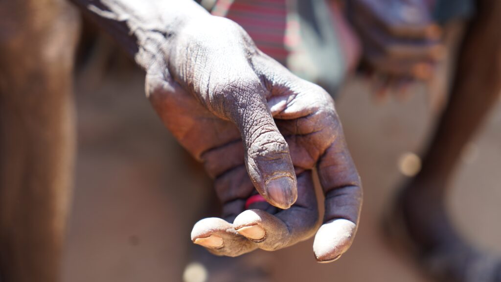 Eine Nahaufnahme der verwitterten Hand einer Person, die eine kleine rote Perle zwischen Daumen und Zeigefinger hält, wobei das Sonnenlicht die Struktur ihrer Haut hervorhebt. Der Hintergrund ist unscharf.