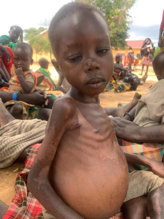 Der Ausbruch von Ebola auf dem afrikanischen Kontinent hat nicht nur massive Folgen für den Tourismus, sondern trifft vor allem die Menschen vor Ort – insbesondere Kinder und Familien.

In Karamoja war die Versorgung mit Lebensmitteln bereits zuvor schwierig. Durch die aktuellen Ausbrüche verschärfen sich die Engpässe nun weiter. Viele Familien haben kaum Zugang zu ausreichender Nahrung und medizinischer Versorgung.

Wir versuchen mit allen verfügbaren Mitteln, diese Situation zu entschärfen und die betroffenen Menschen zu unterstützen. Jede Hilfe trägt dazu bei, Lebensmittel bereitzustellen und Hoffnung zu schenken.

#Afrika #Ebola #Uganda #Karamoja #HumanitäreHilfe Kinderhilfe Spenden Hilfsprojekt Nothilfe GemeinsamHelfen Lebensmittelhilfe HumanitarianAid
